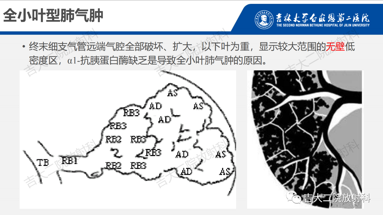 31455cbce060c704c5bfec9e55853f2c.png
