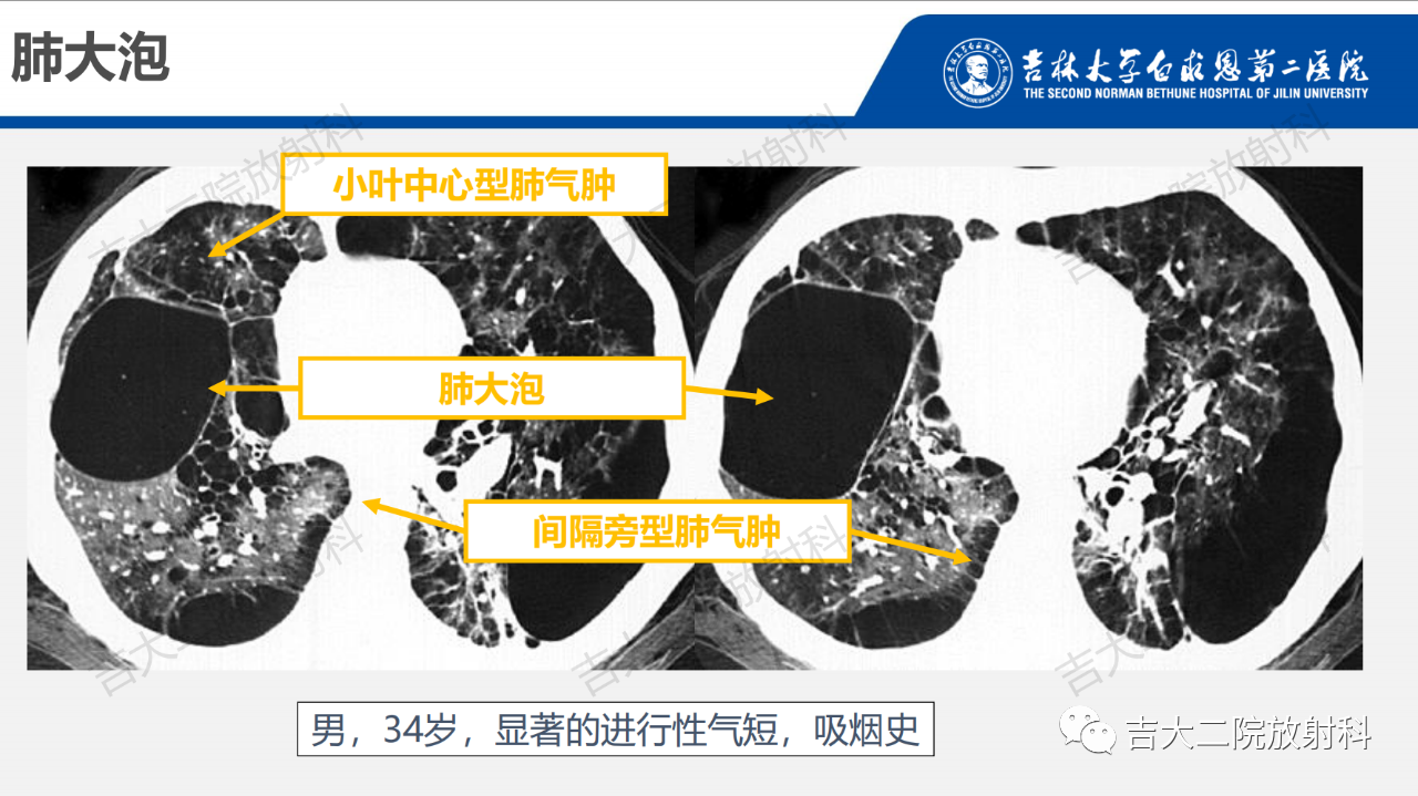 2e7bf5cd77cfa76a2666f3c923ad6088.png