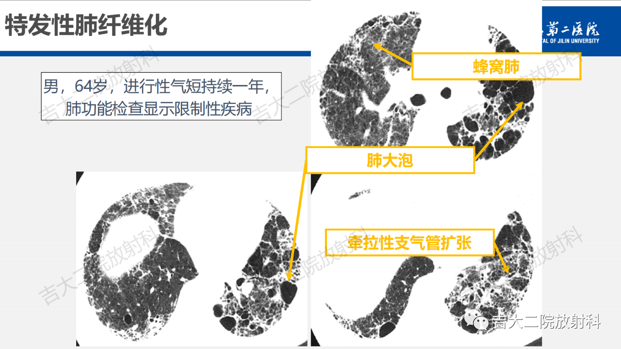 c6d291ef55e14f397b73fc7f43320c4c.png