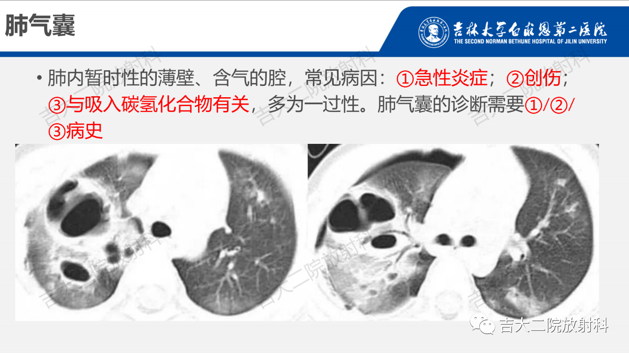 4d60d4bb87db32ec1e0197a31404eacd.png