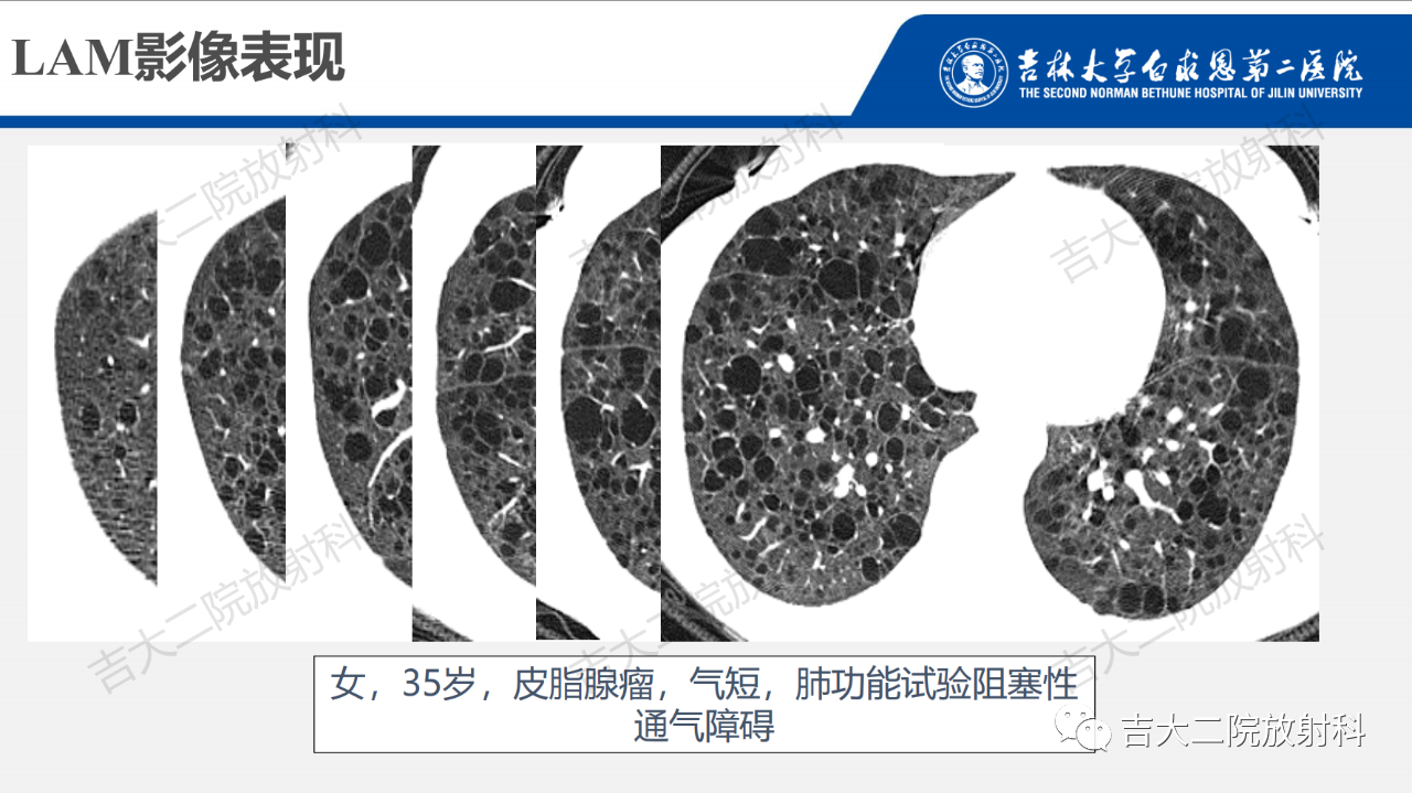 a98638ea6891c9abe8e536bd26fc0e4a.png