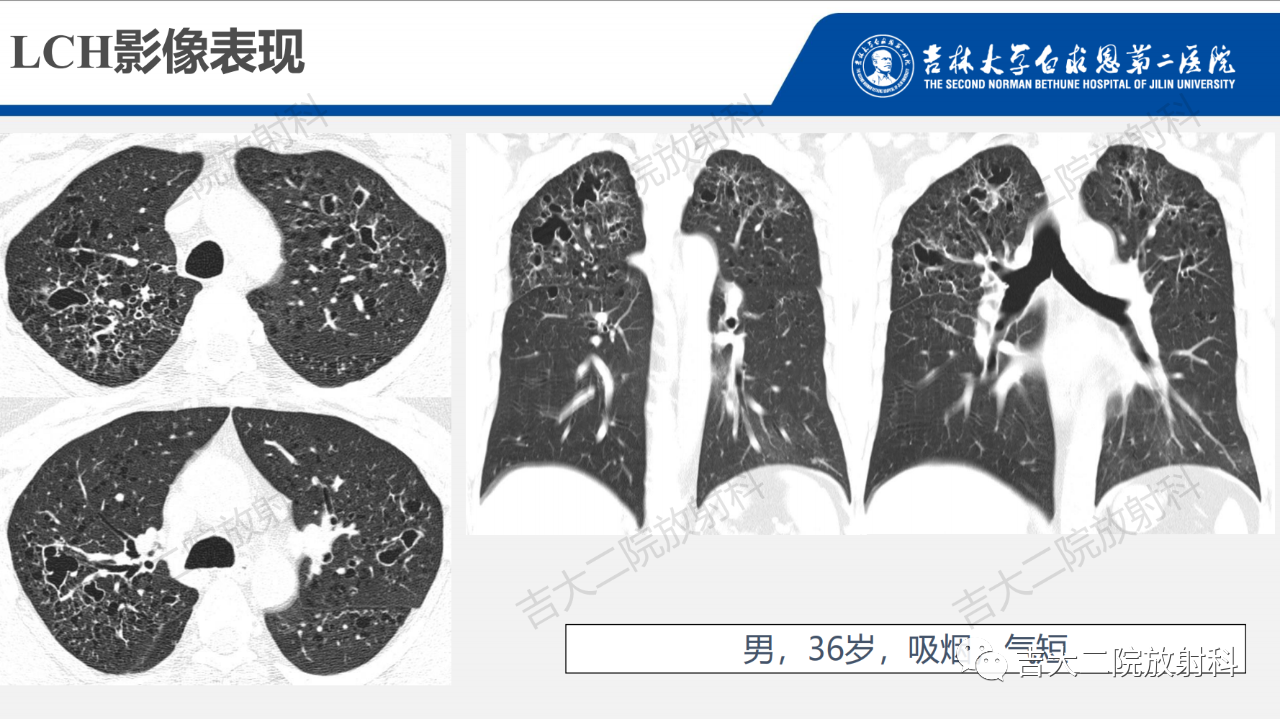 cf403a32def4f6d780694c36442e44d6.png