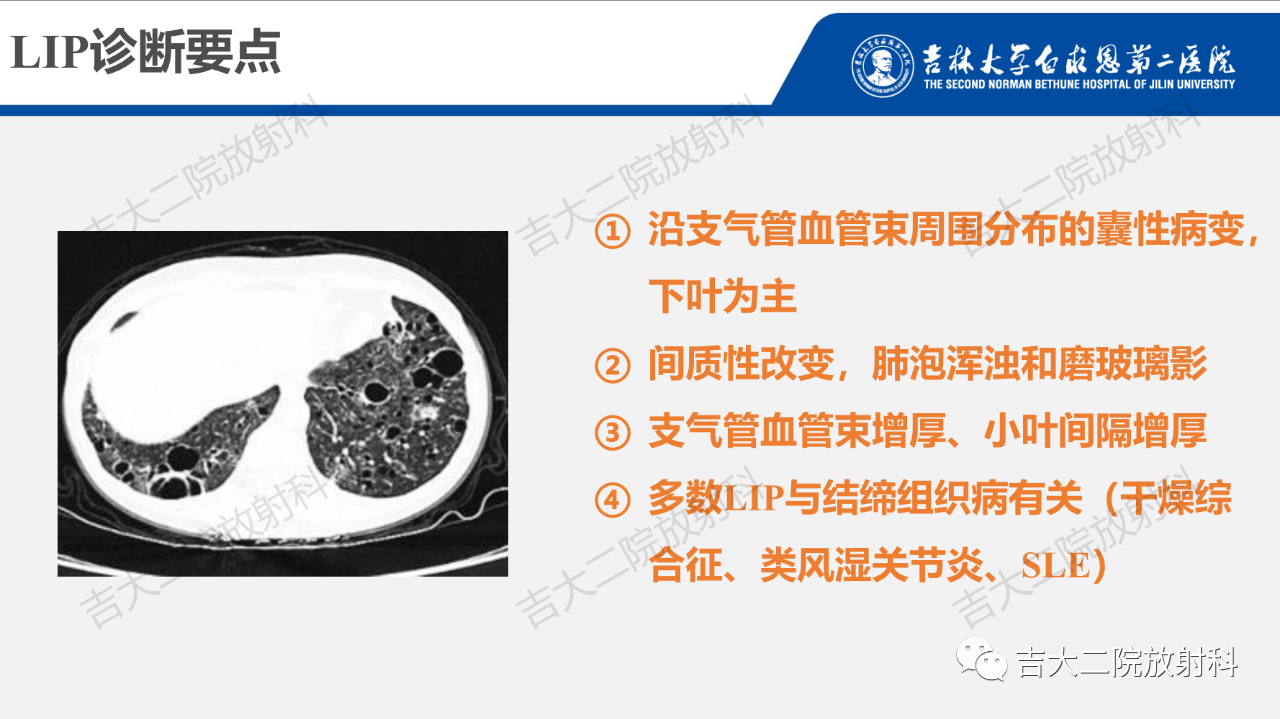17a0a58cd5d06142782f44b9fb9e3a10.png