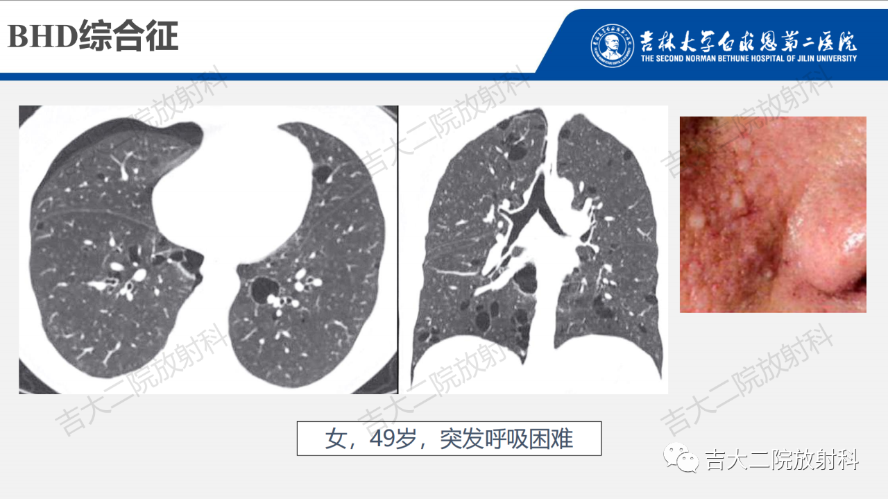 9cc88311a04ab2ab8b840d9e0edc1cef.png