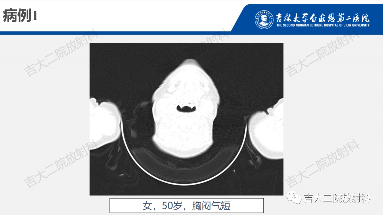 560ac02b994f9c52838b46e8fca9225f.png