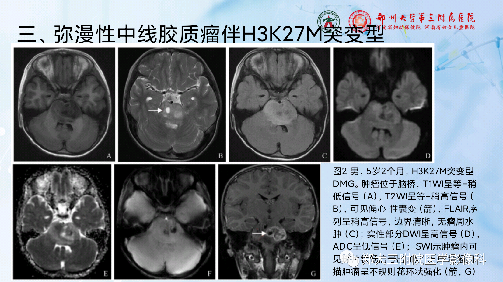 c618eb92dc70d8a3a71a99488b9c4950.png