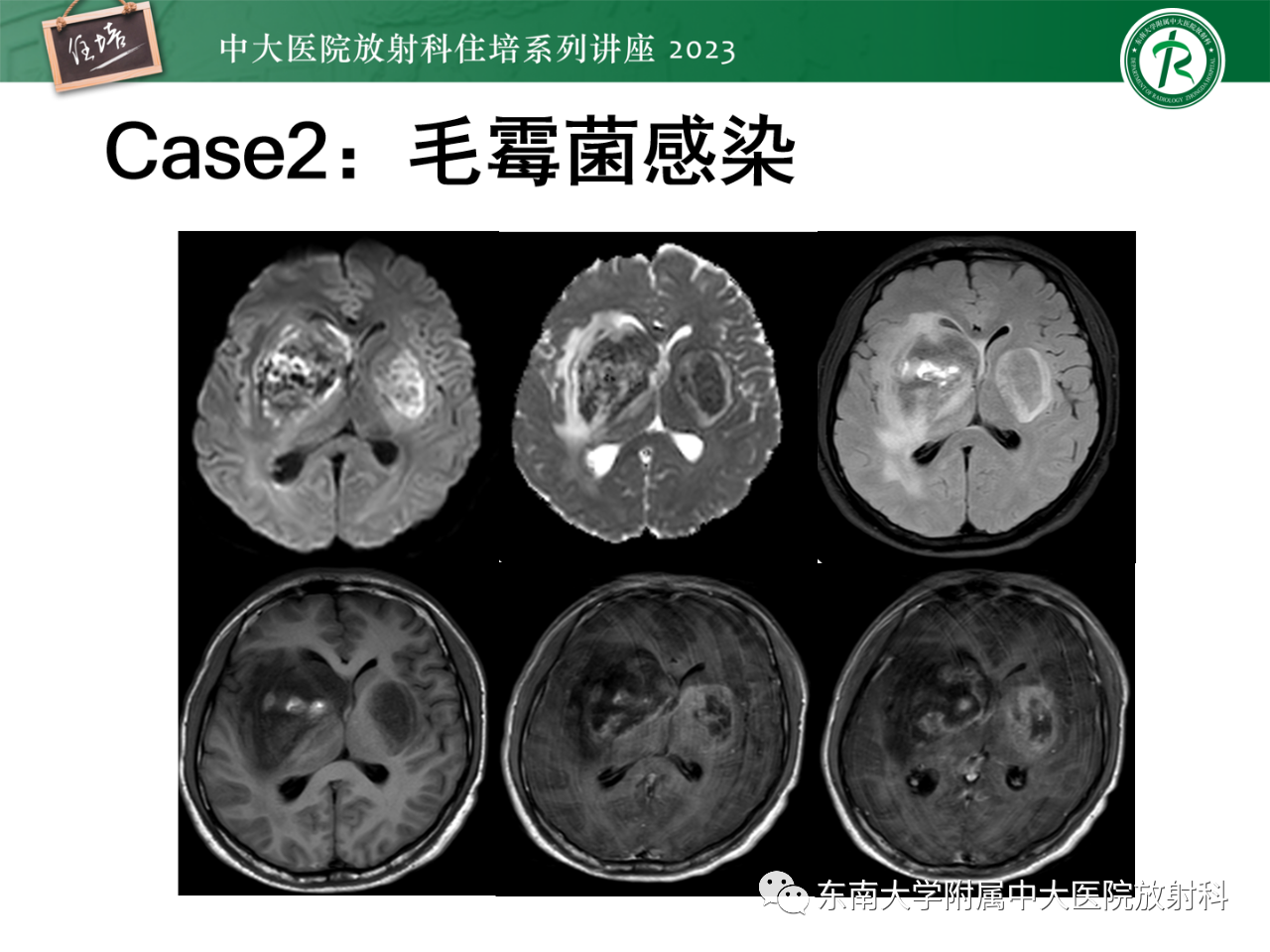 23a80ada90882e93fac7574fa1a68d96.png