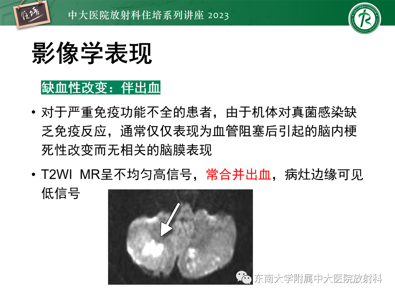 123be6c6d481aa38f4a9cf475bf0b1c5.png