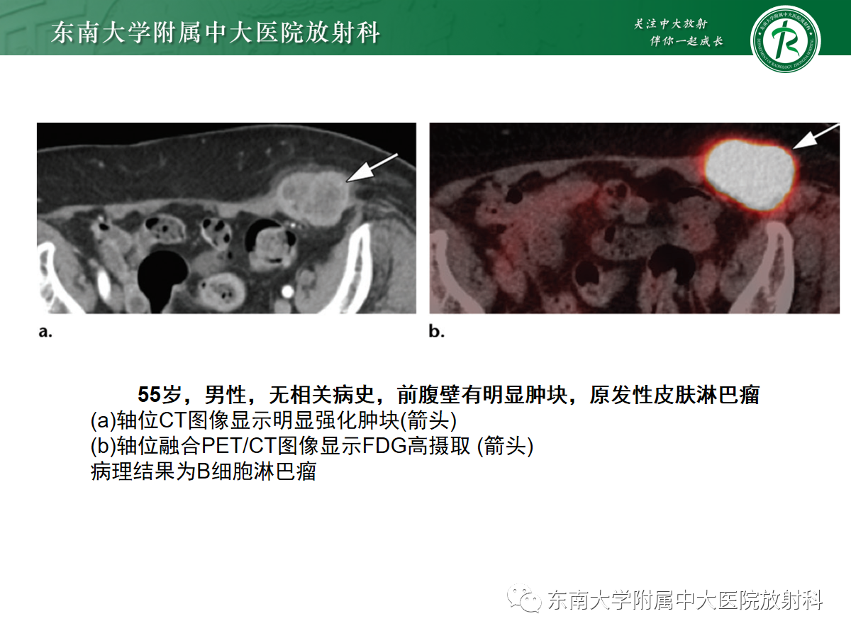 4b31974c5872c7fc320240406e956ba6.png