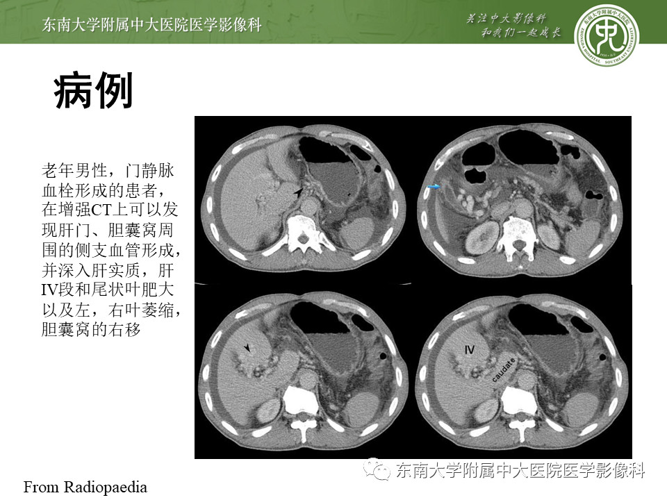 bee22b8175afa843ebc1767abfaff070.jpg