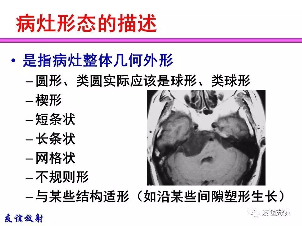 0ae1f594c39aeae0d64efcf6720cddda.jpg