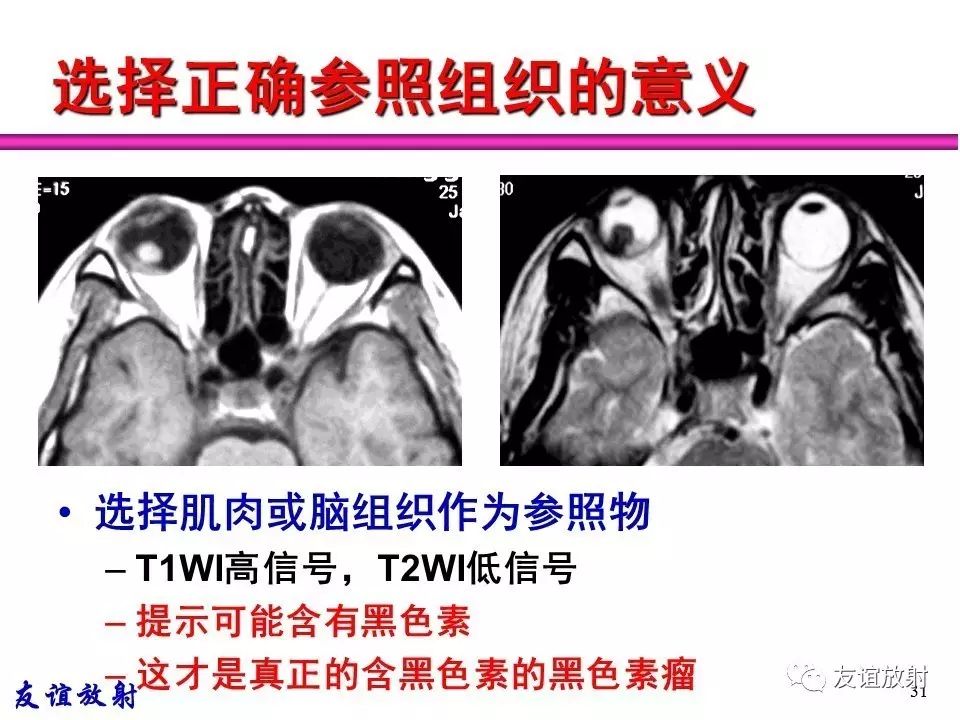 805aed766624fbf16f5bfdfbf2a4ad01.jpg