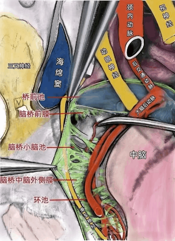 f209487b3f91935e49e36fdff46c0f9a.gif
