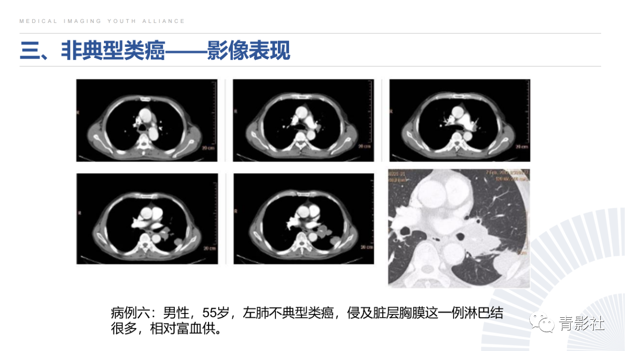 1b44415d73817215bf4a3fb835fa0dc4.png