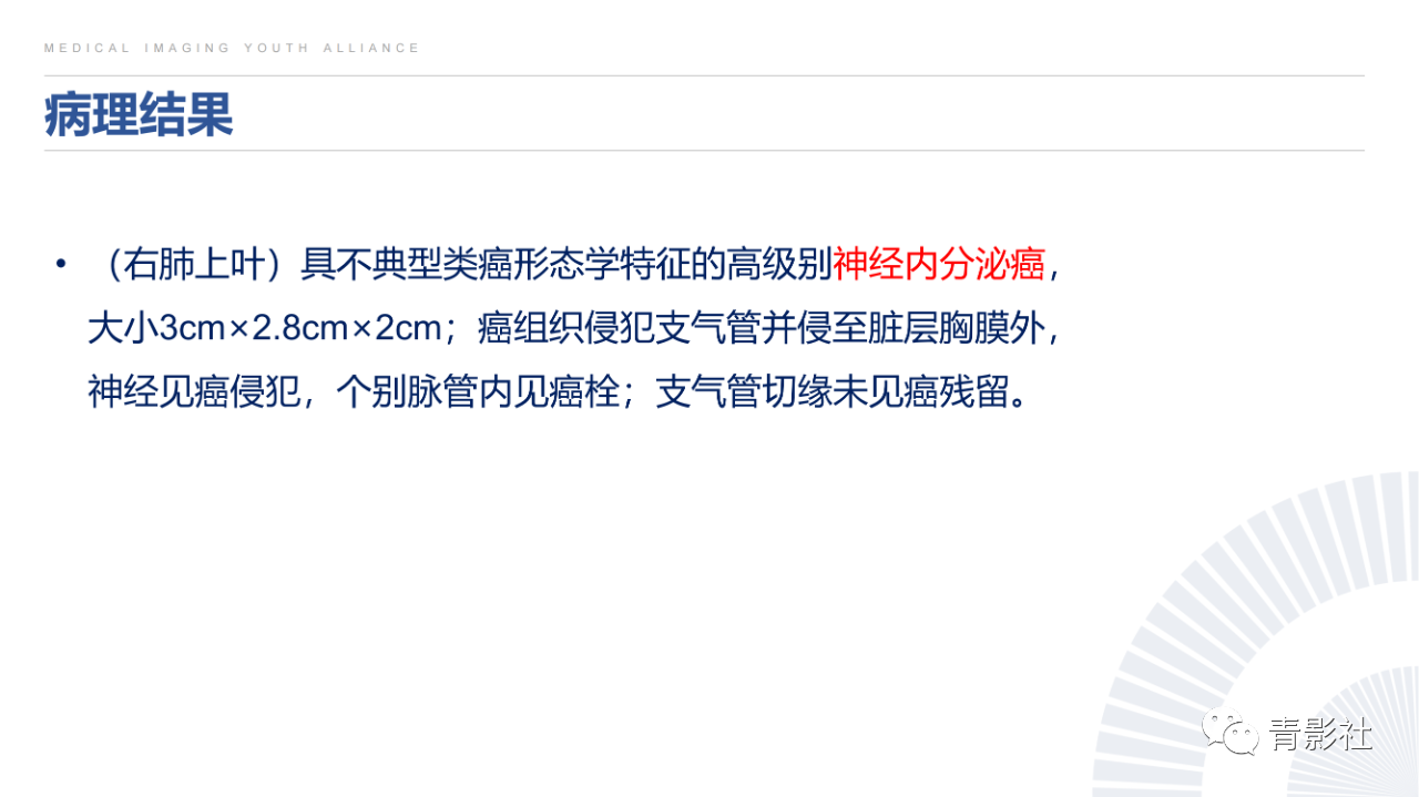 e84cc56efc75eb076198374a6c6d8386.png