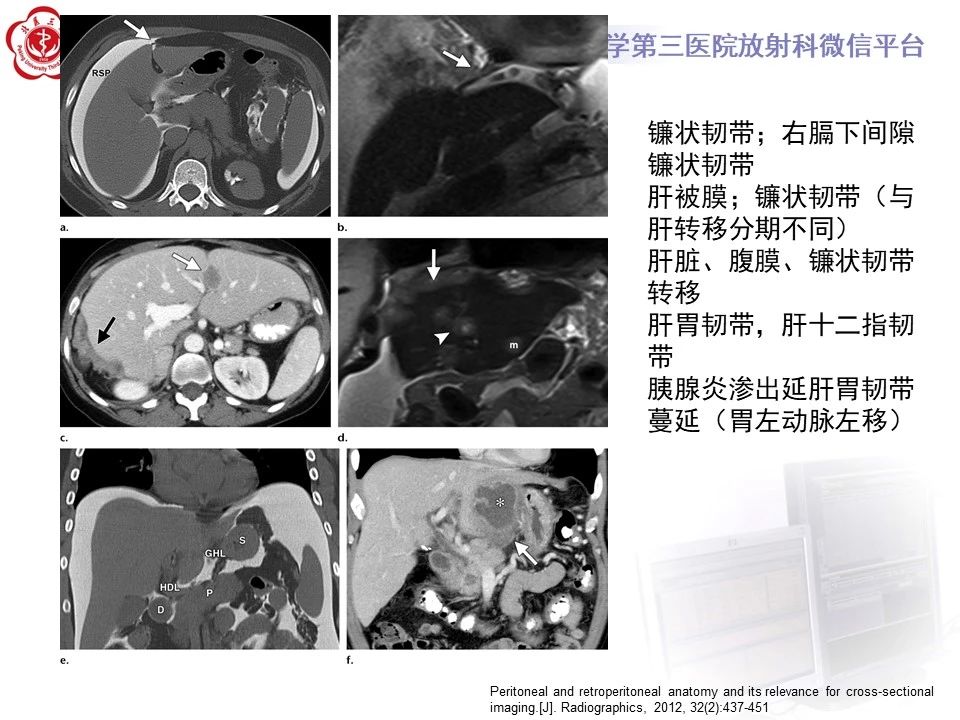 aba5f598d4fc7b6a85a32cf87c5c8598.jpg