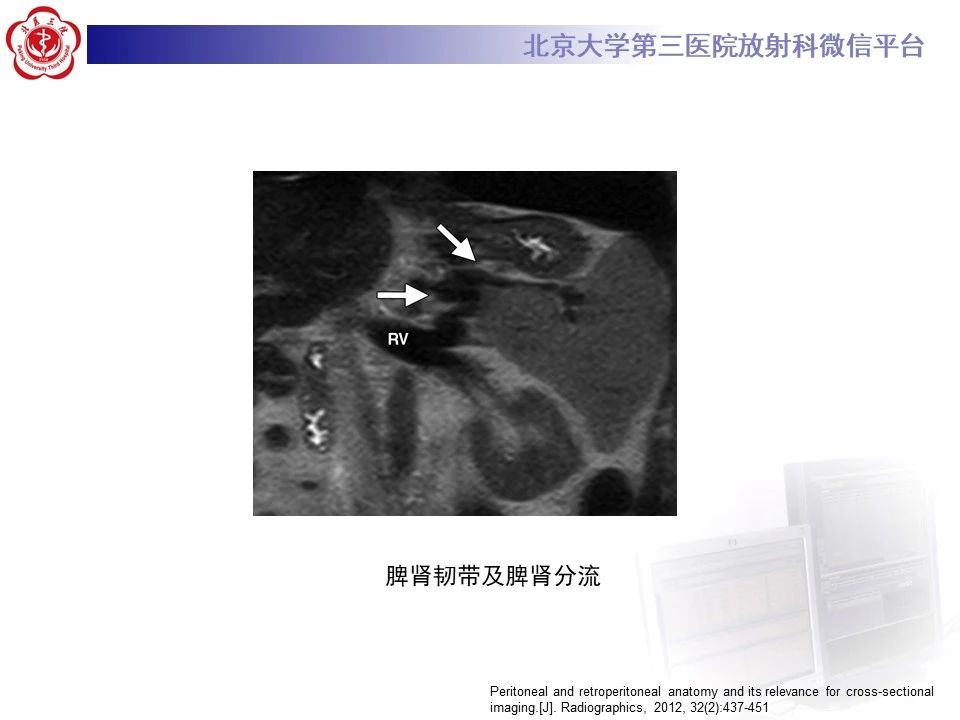 3fd3cefc5f400517a85a718aa65e884d.jpg