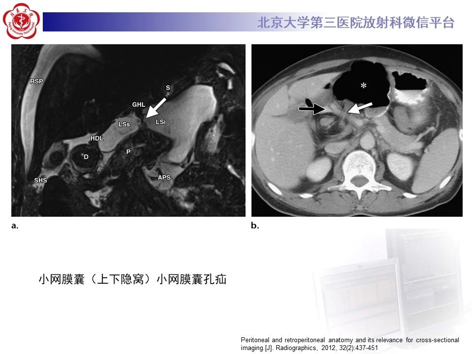 d9f284adc8c2627bebb78952d828e1ca.jpg
