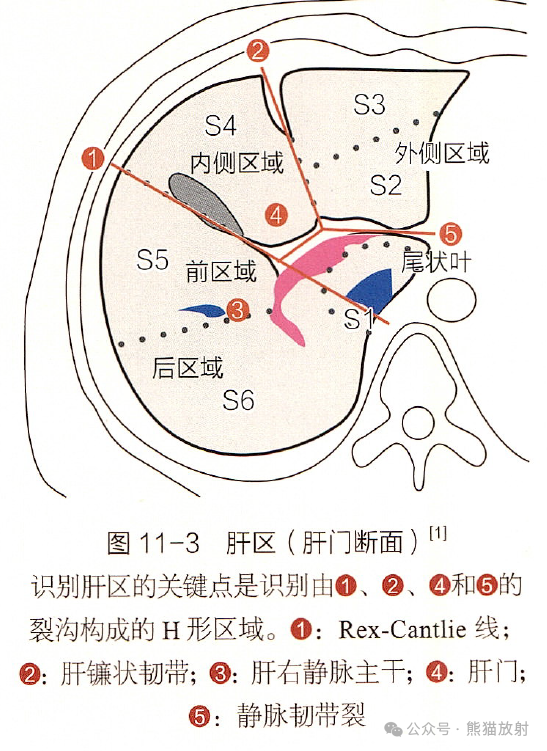 qw5.jpg