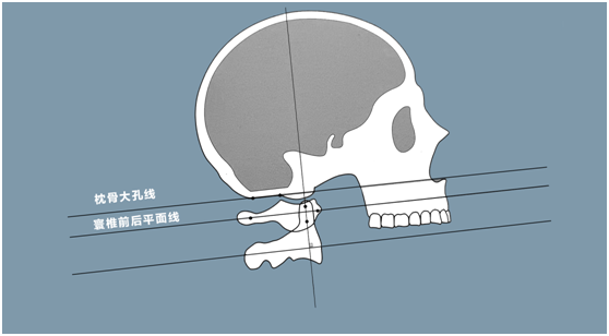8e8bef4ec040dd447ba9c9c4500ac523.png