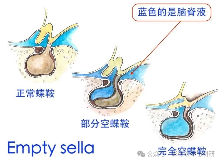 ce84c59e5a6d582cbd0f45a213843270.jpg