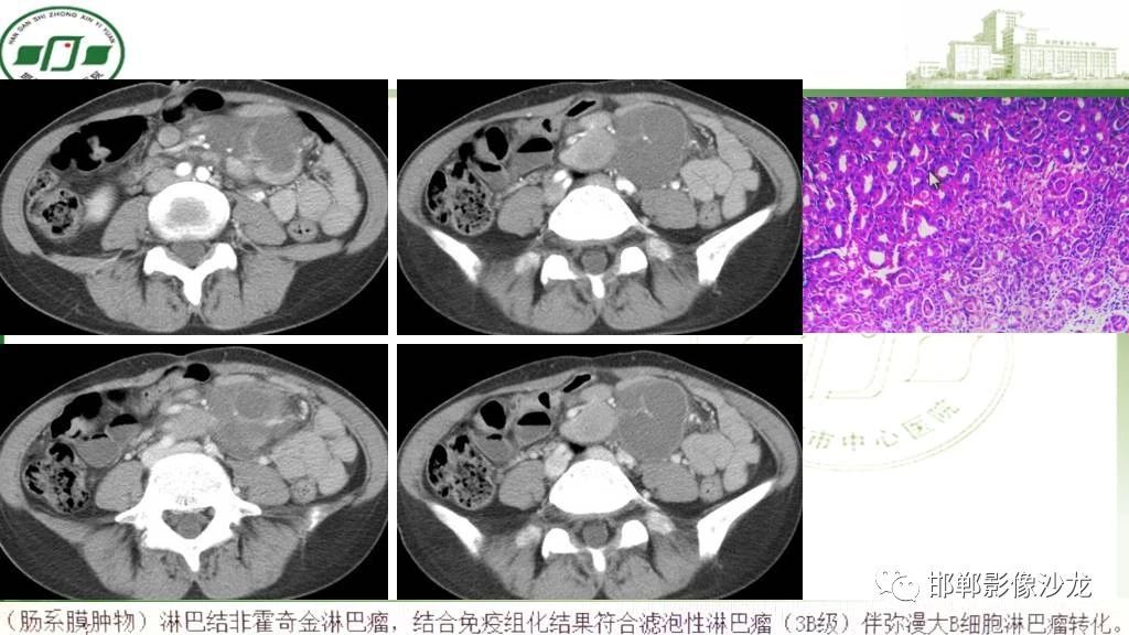 cd4a1c6b07fd24dc0fdbf17cd725f3bc.jpg