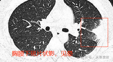 b6e8faf0c45dbff5f76b1f286768f8f3.png