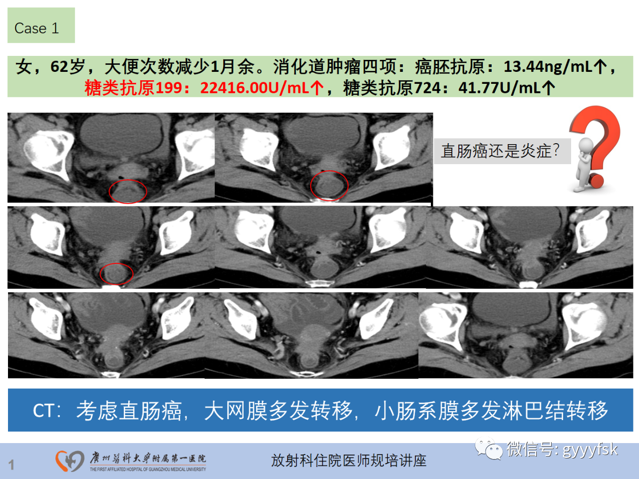 dd29af43fdb97d8fb4543d8352c8662e.png