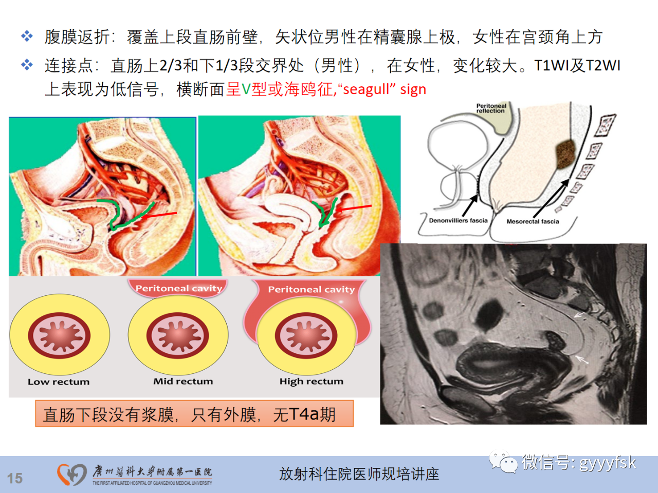 b991aa3f8ffbfbd0300a0a308d695558.png
