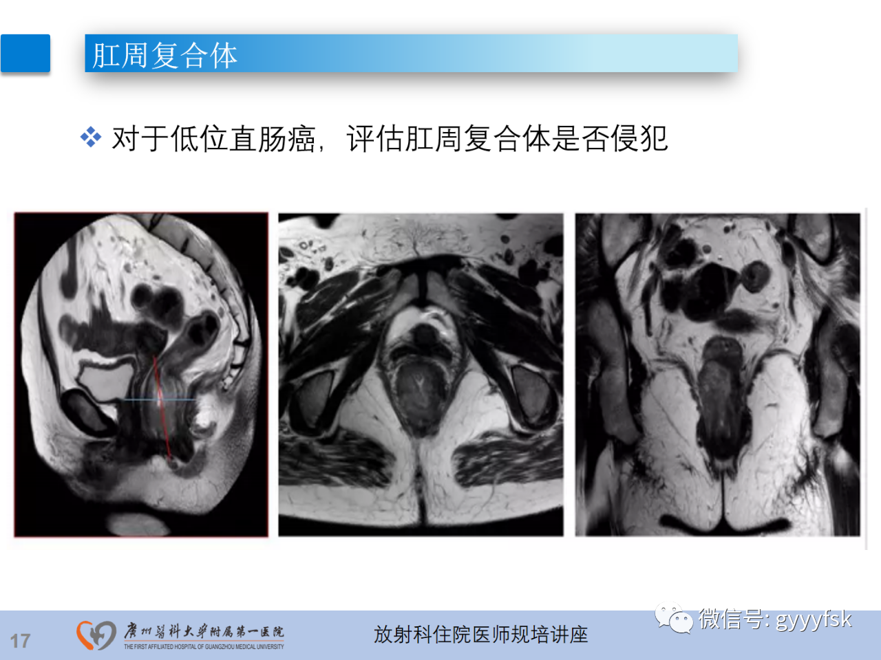 1b9270f9fda8cc0d9abea0ca6ba7df2b.png