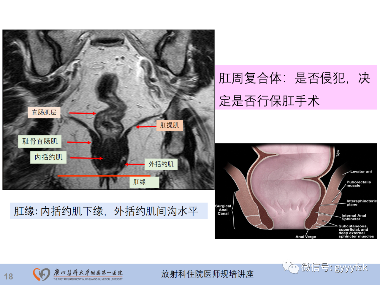 1a1bc691b8266585bfb906ff6a06142d.png