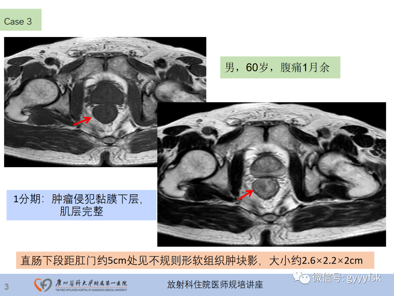 2cabb96ab737ab6d9657331566717393.png