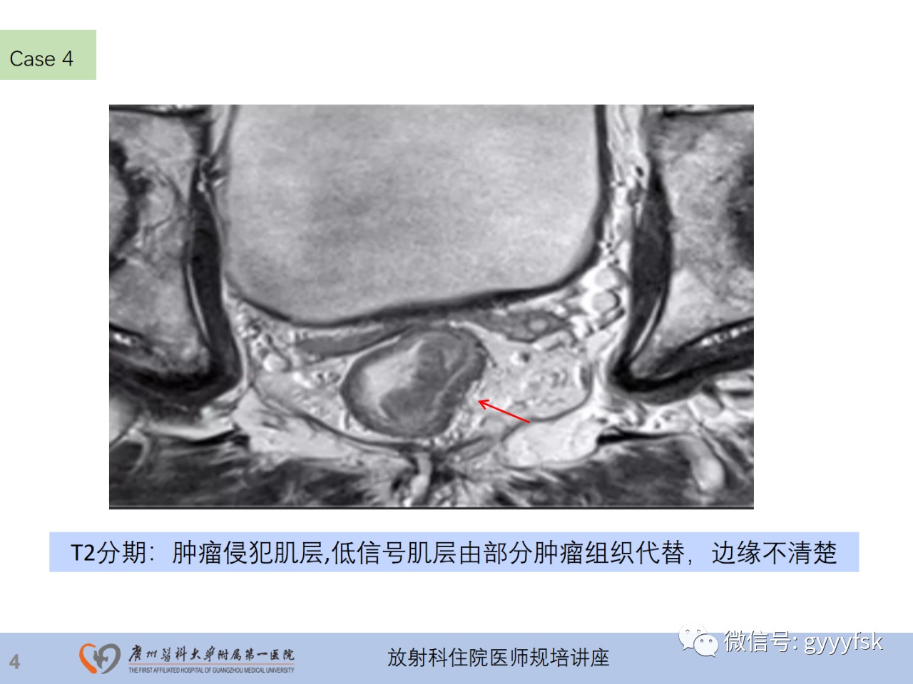 11ca5d53d30968aadb08d096c606db23.png