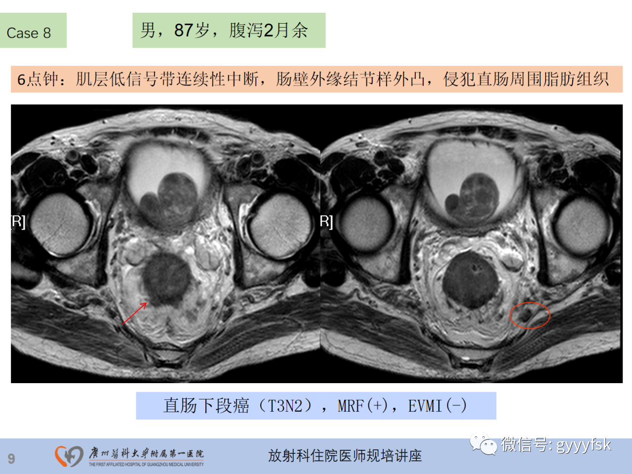 263aaff54a8ce9cbc2335f5e0938c544.png