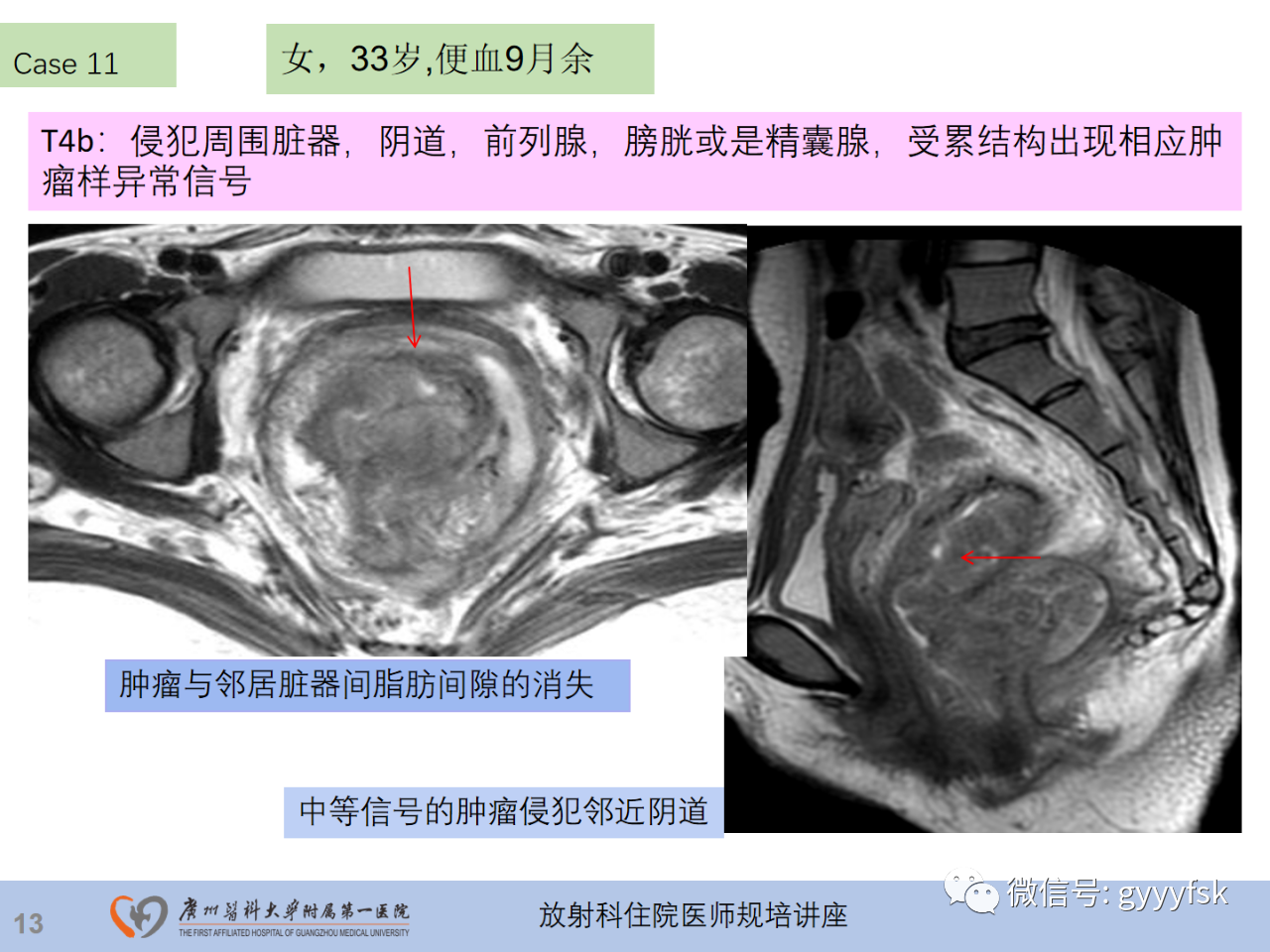 eba3c90438f61faa87309e338d1cd529.png