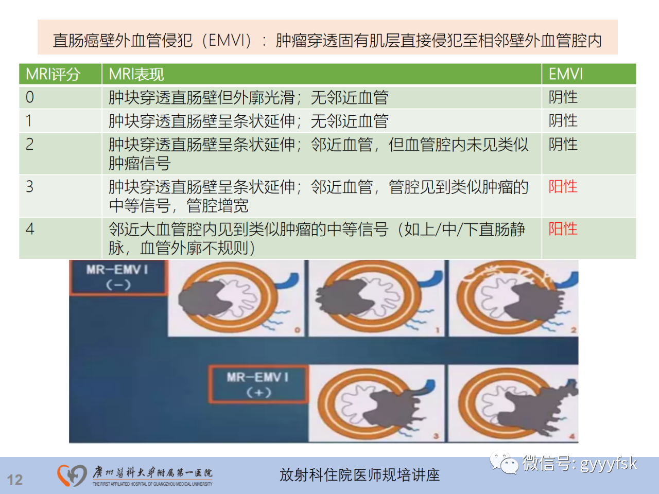 b2895f47851d808a63e95f979f95ca76.png