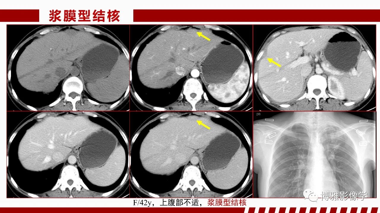 dce80174d32c31e4ab268059ebfd67fe.jpg