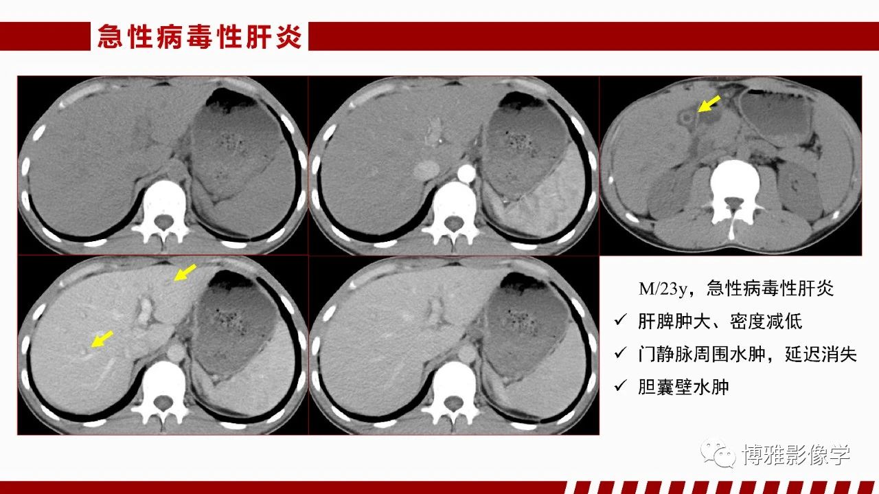 b7490f45961860c8136ee9469cd150d4.jpg