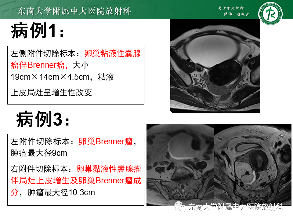 2a4f7f6a3d40d9dbb643afe8be84b15f.png
