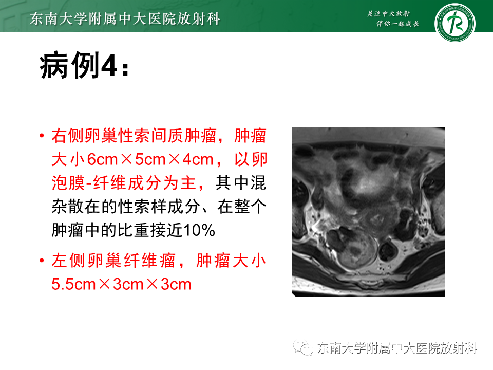 8acb816ee563895f6d703675c0d9b45d.png