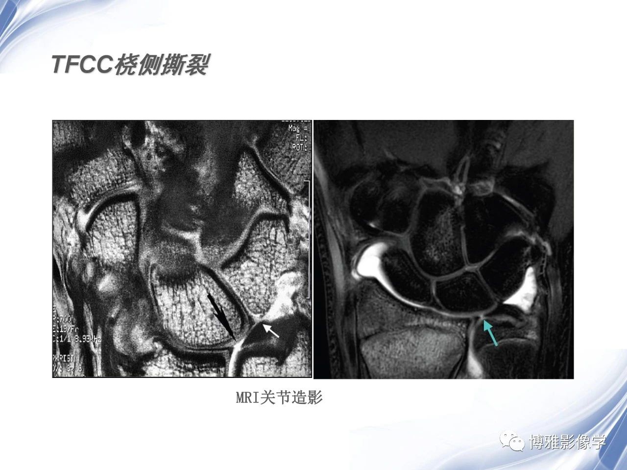 9dd470db603d2e32b6abbea6fc1c3b11.jpg