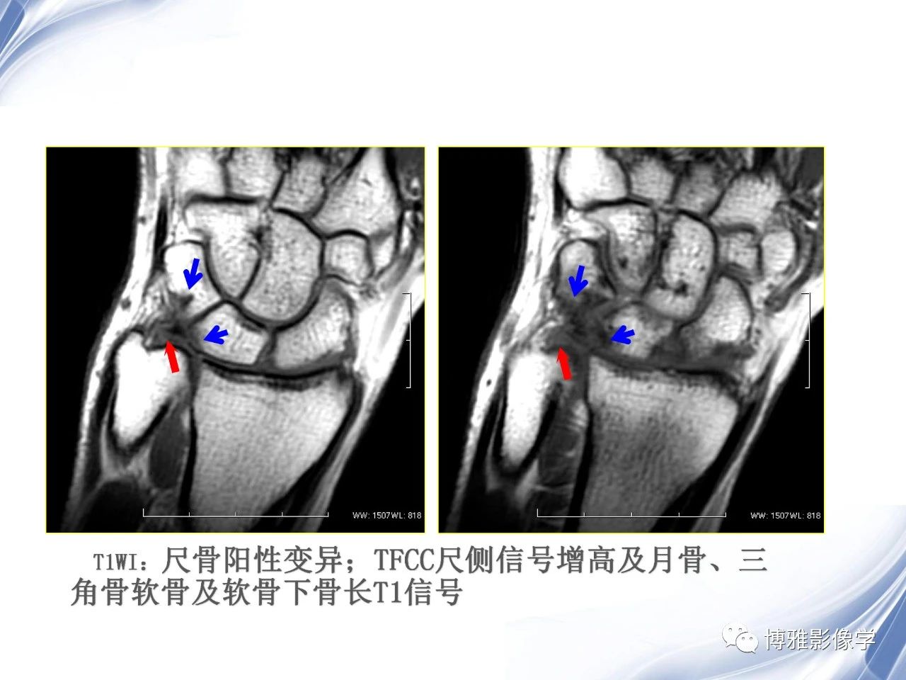 2e4c1c7e9bfdbbe56fca924678cf7cb4.jpg