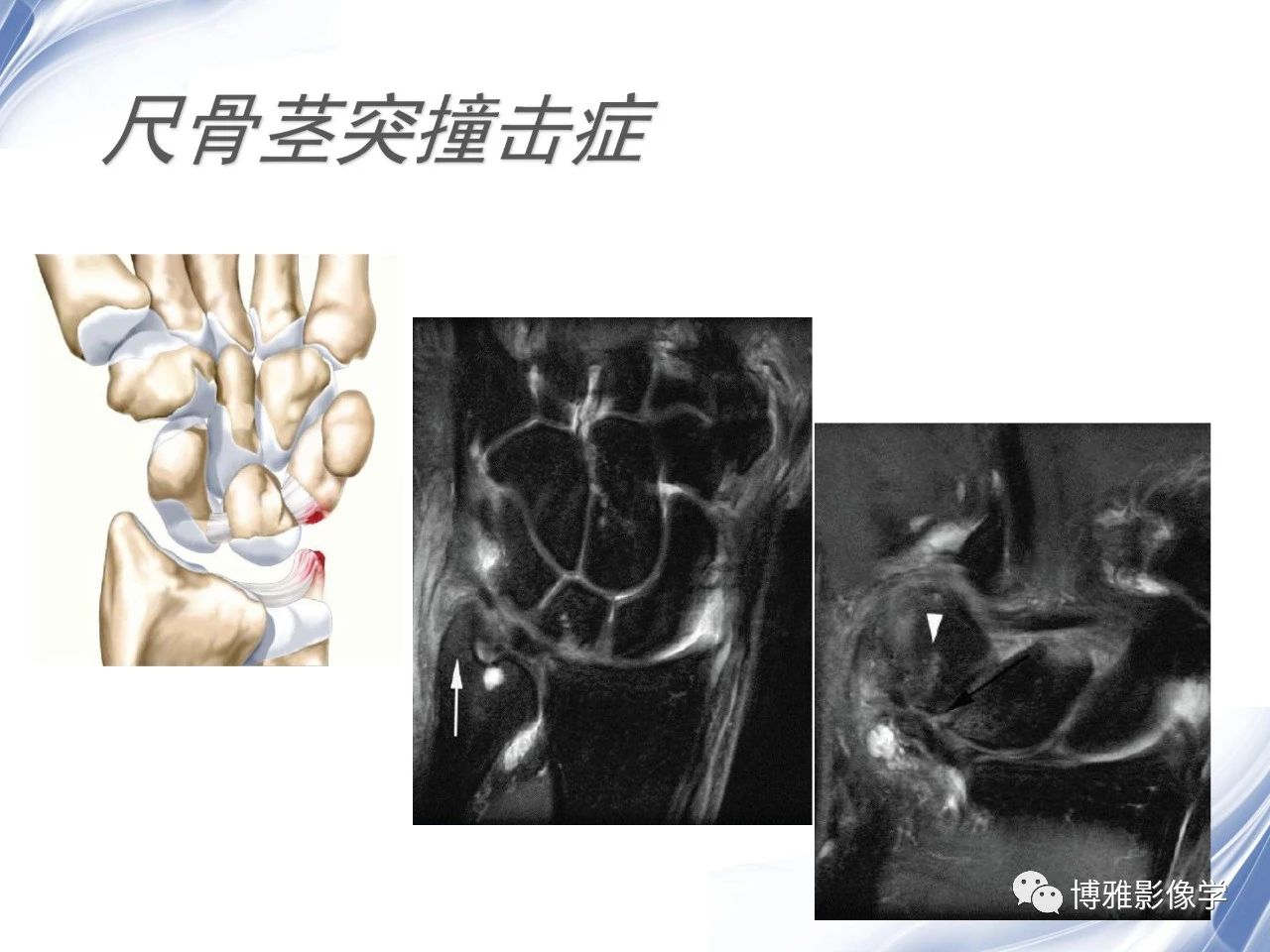 2090e25c28f41ace116080c81dfdbbac.jpg
