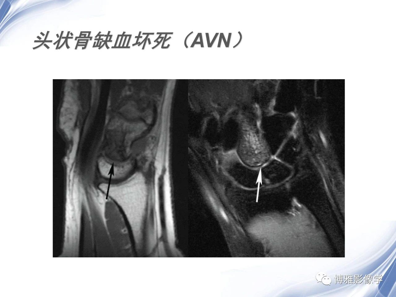 ef82a9b8da11a57cdb352370f95d52e0.jpg