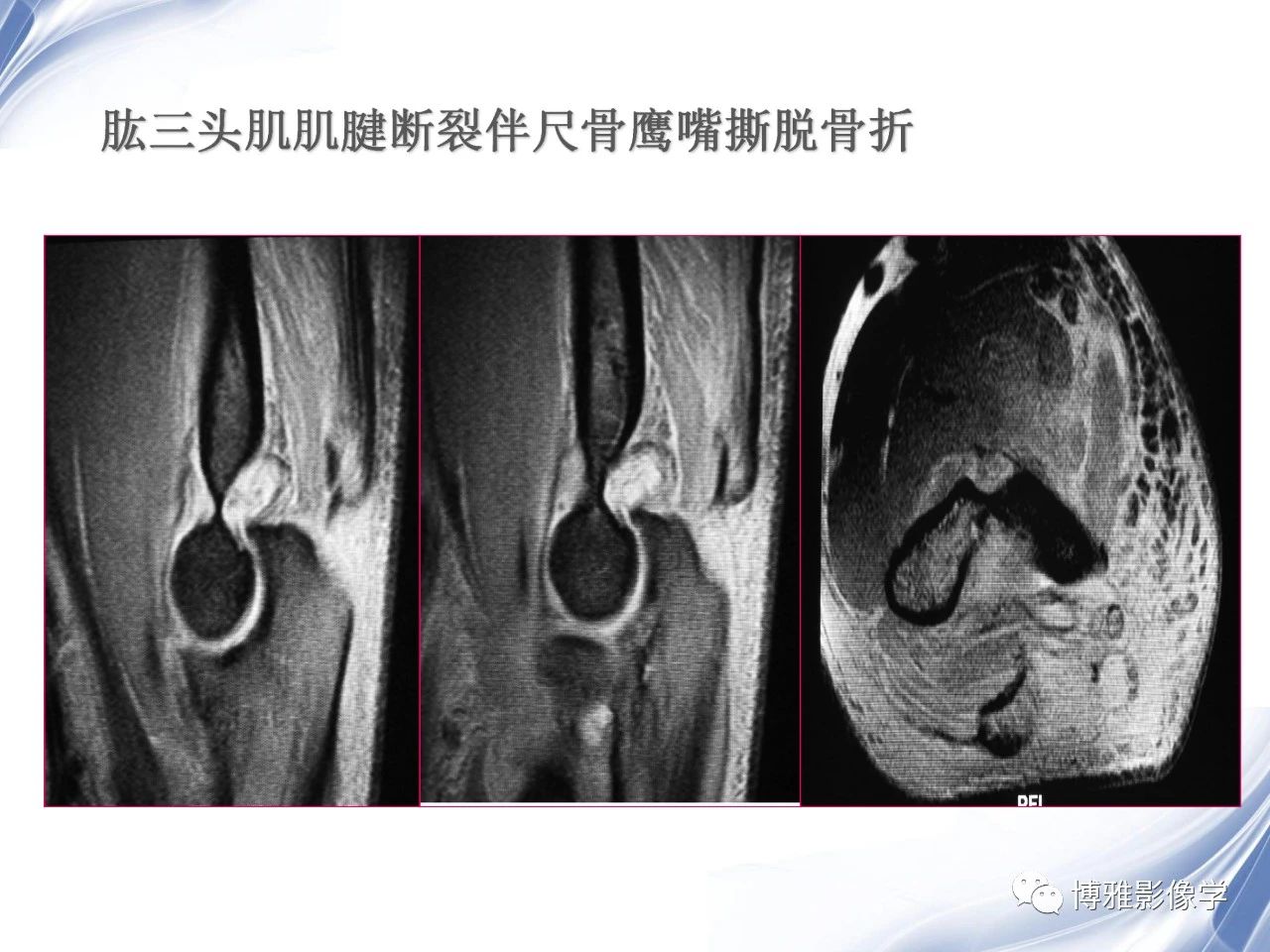 a2e20bc1683a54bdc96b642b1cf9aa39.jpg