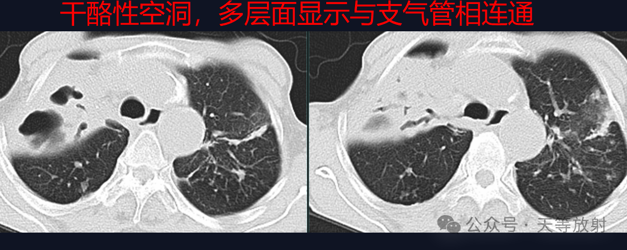 ed991393eff3ecb9208d9c1d069a38dc.png