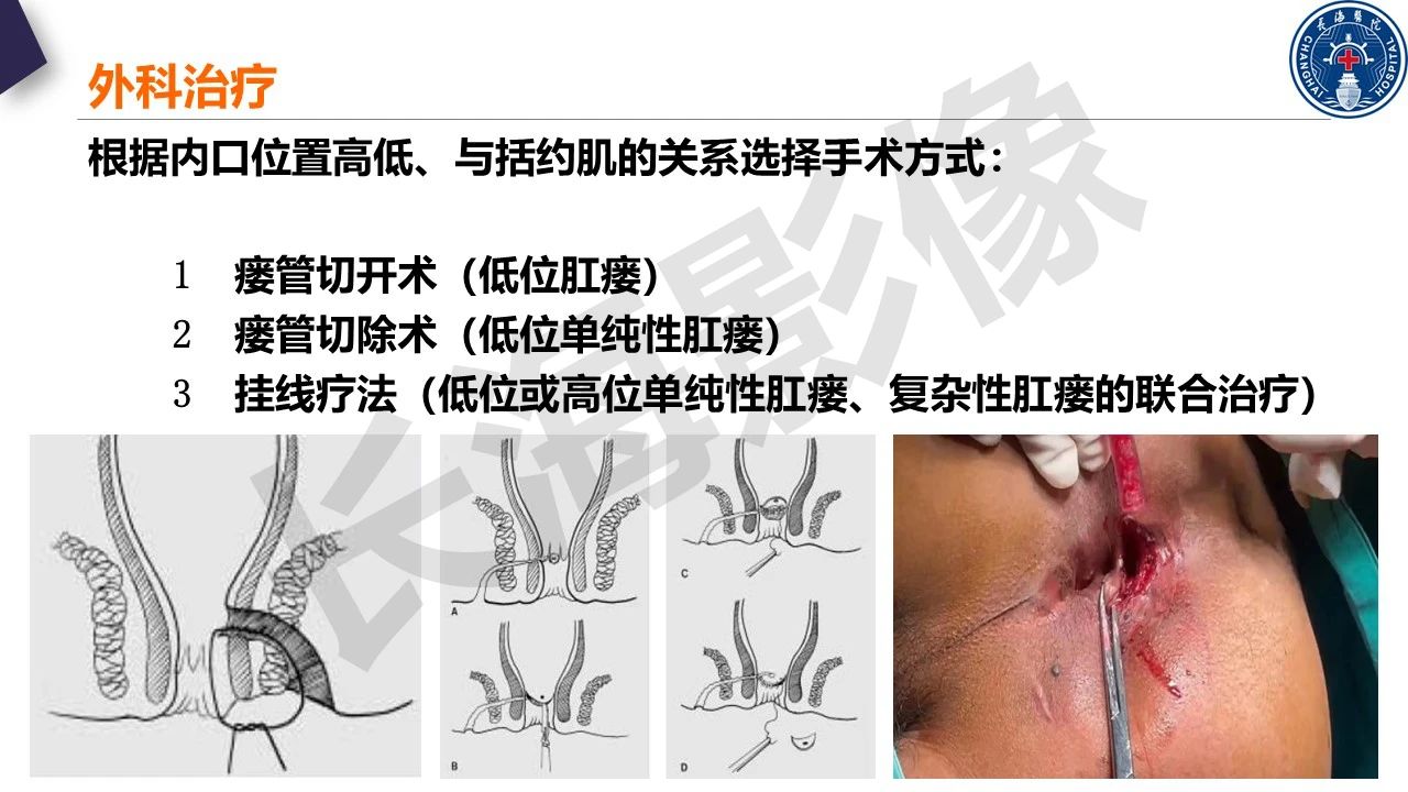 d323cb18eb1545d0792c3723824c32e6.jpg