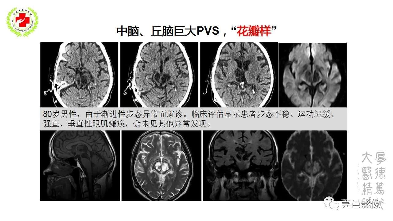 b28a2947724c0cbde90cd0782ecca920.jpg