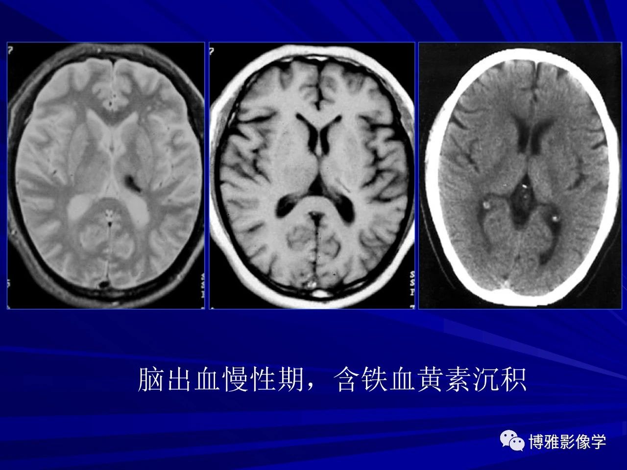5c553dfde5983daa70e317a155332eb9.jpg