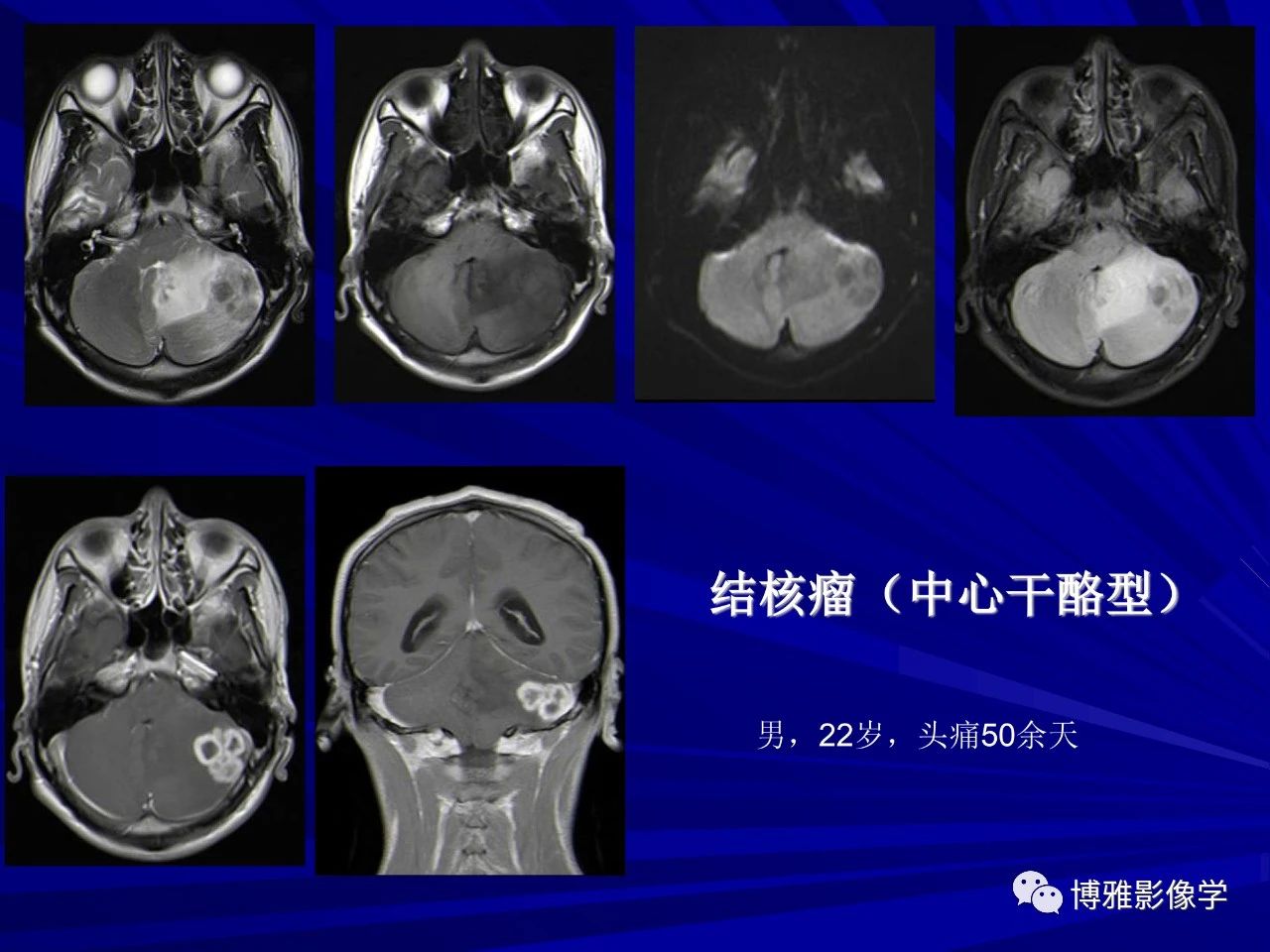 d7747cf50a1cc4371a6dc3ce449e3238.jpg